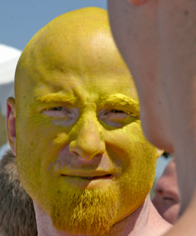 Желтый цвет лица причины фото