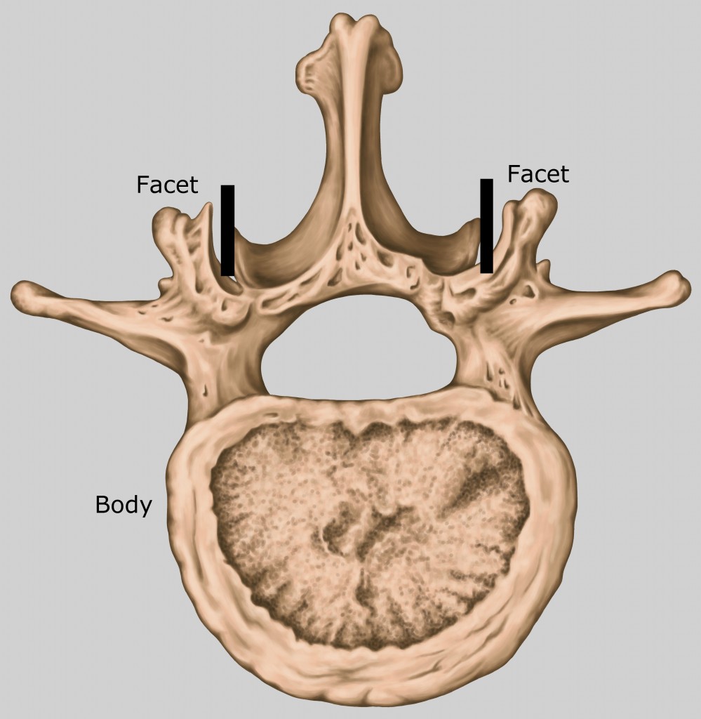 picture of lumbar vertebrae